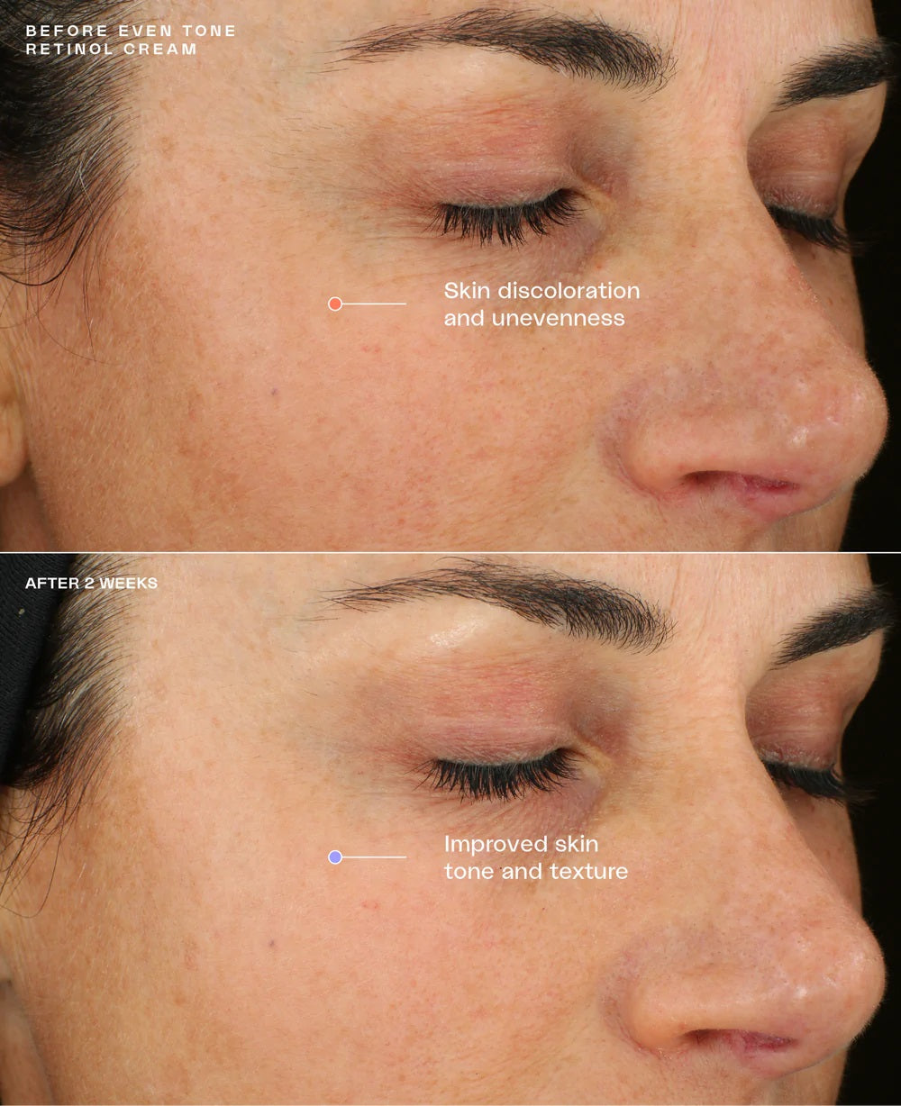 SENTÉ Even Tone Retinol Cream